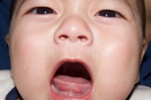 乳児 咳